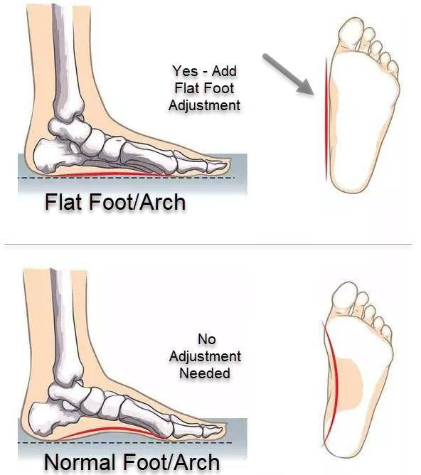 LOW ARCH -This is a physical adjustment to the shoe Z-CoiL Pain Relief Footwear